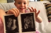 Brianna is going to be a big sister! Granada ES
